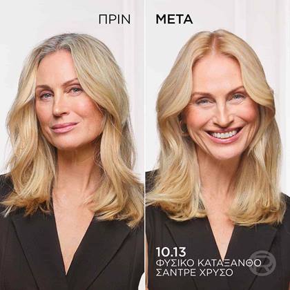 Excellence Age Perfect Nudes πριν μετα
