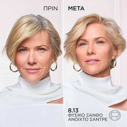 Excellence Age Perfect Nudes πριν μετα