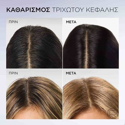 Elvive Hyaluron Pure Shampoo Πριν Μετά