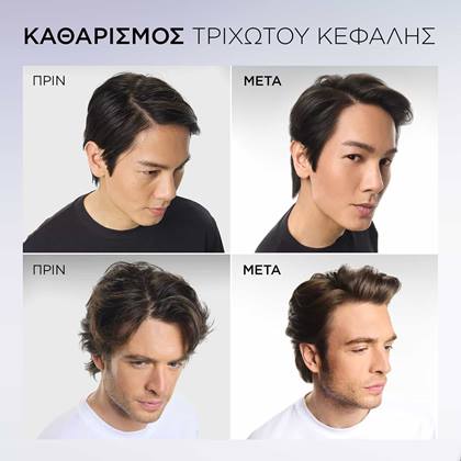 Elvive Hyaluron Pure Shampoo πριν μετά τριχωτό κεφαλής