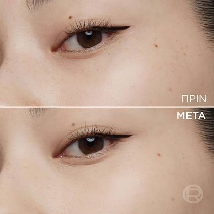 Soft Glow Cushion Foundation 3 Before & After