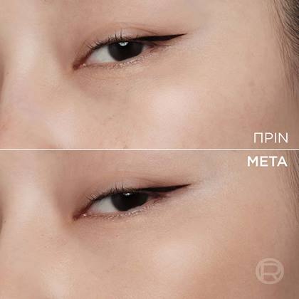Soft Glow Cushion Foundation 4 Before & After