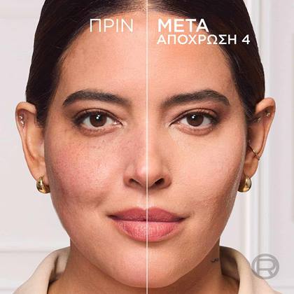 True Match Hyaluron Tinted Balm Πριν & Μετά 4 ATF03