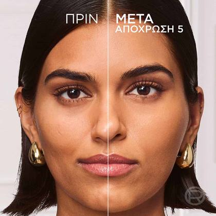 True Match Hyaluron Tinted Balm Πριν & Μετά 5 ATF03