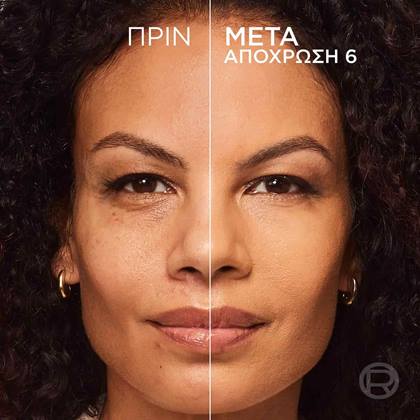 True Match Hyaluron Tinted Balm Πριν & Μετά 6 ATF03
