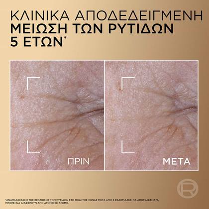 Age Perfect Le Duo Ορός Αντιγήρανσης Προσώπου Πριν & Μετά