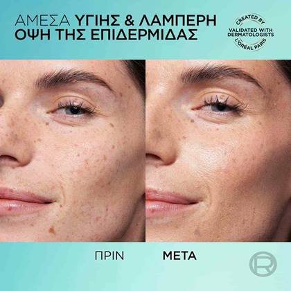 Bright Reveal Daily UV Tinted Glow Ανοιχτή Απόχρωση Πριν & Μετά