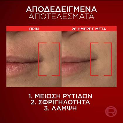 Revitalift Laser Κρέμα Ημέρας Τριπλής Δράσης Πριν & Μετά